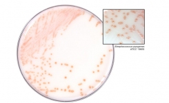 在HardyCHROM显色琼脂彩色链球菌A的菌落